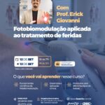 Capacitação em Fotobiomodulação aplicada ao Tratamento de Feridas